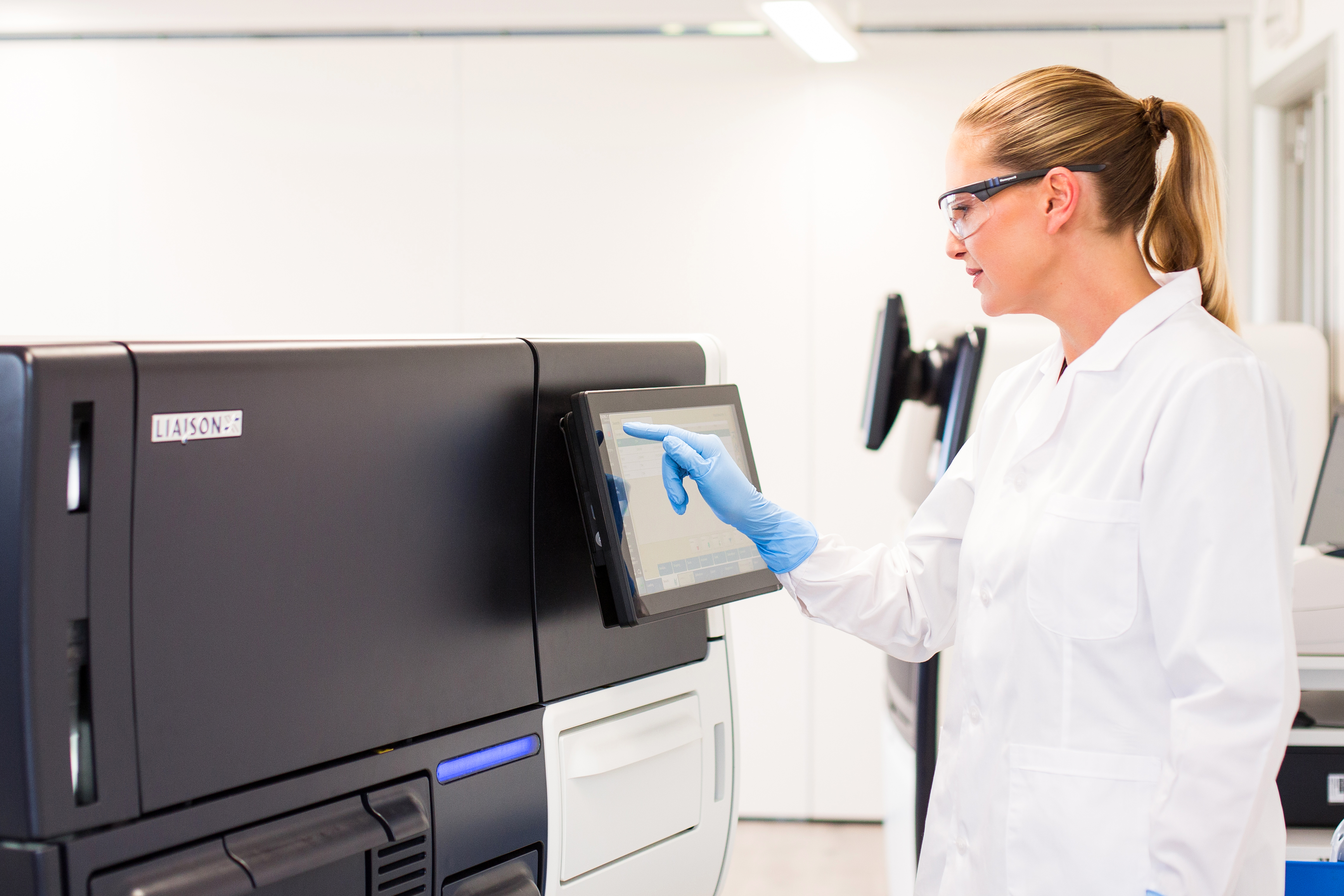 LIAISON® Calprotectin 