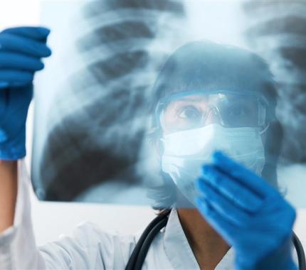 Legionella Urinary