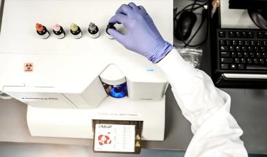 Bead-Based Multiplex Assay Shines in Performance Analysis