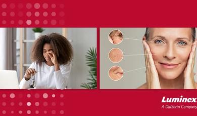 xMAP® Connect: Advances in Aging and Dry Eye